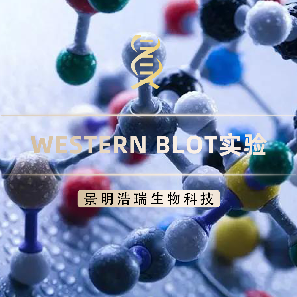 WB(核蛋白、线粒体蛋白、膜蛋白)